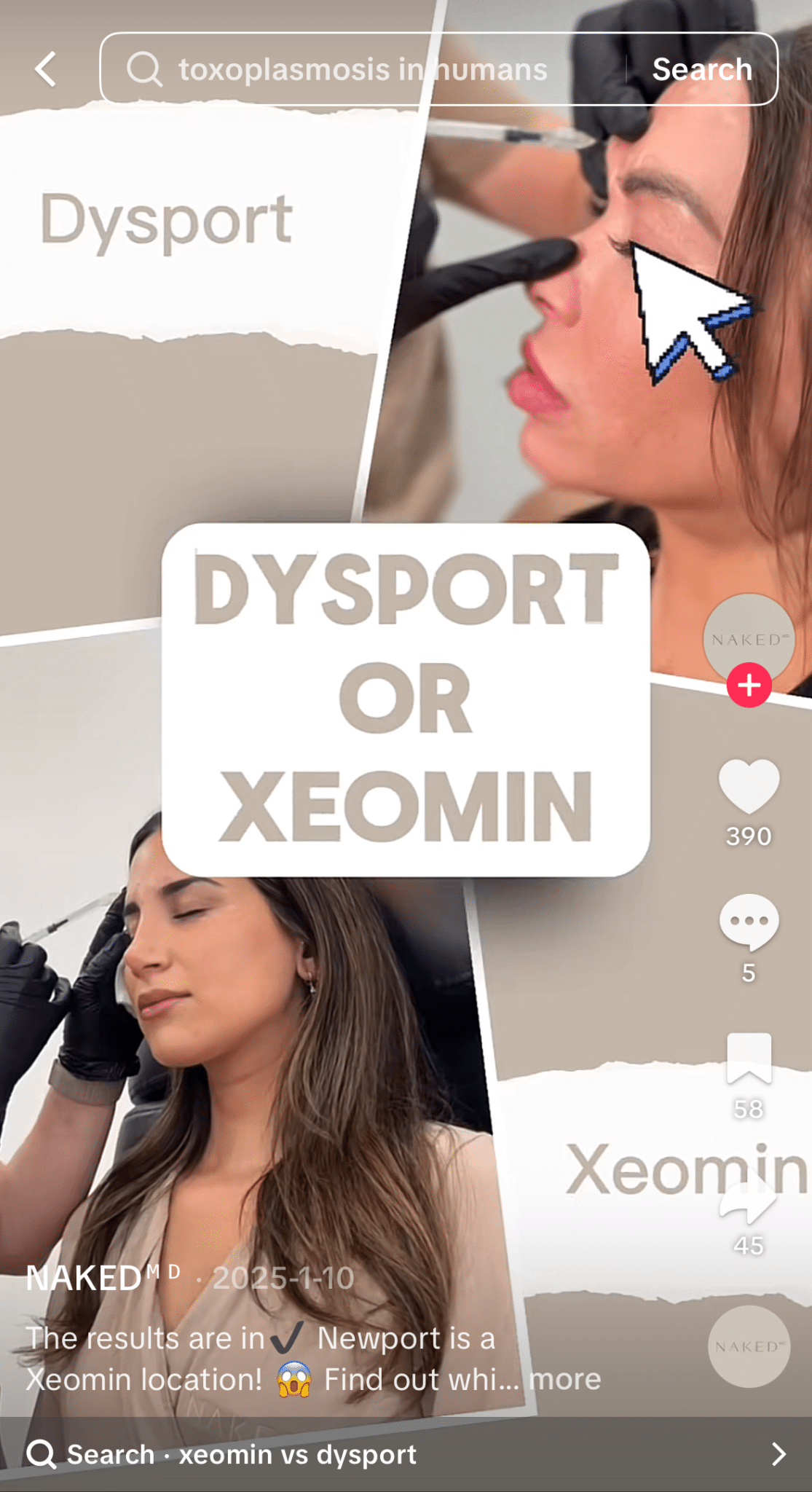 ```json
{
"alt": "Split image showing Dysport and Xeomin treatments on women's faces with text 'Dysport or Xeomin'.",
"caption": "Choosing between Dysport or Xeomin? Discover which treatment might be right for you in this engaging visual comparison.",
"description": "This split image showcases two cosmetic procedures: Dysport and Xeomin, performed on different women. The central text 'Dysport or Xeomin' invites viewers to consider the options. The visual is part of a social media post with interactive elements, including likes and comments. Keywords: Dysport, Xeomin, cosmetic treatment, beauty, comparison."
}
```
